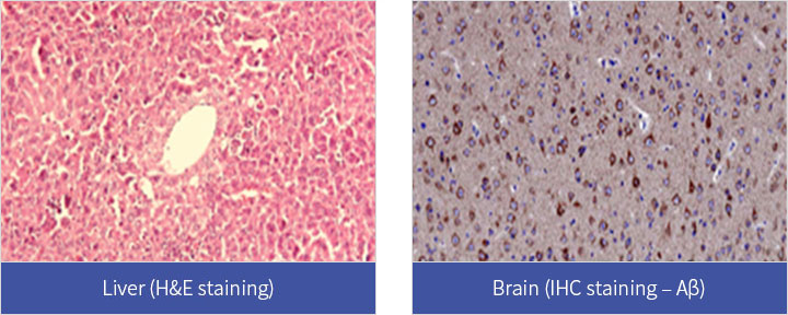 조직병리학적 분석 (H&E, IHC, Masson’s trichrome staining 등)